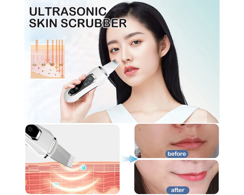 Ультразвуковий скрабер для обличчя Ultrasonic Facial Beauty Device Ультразвуковий скрабер для обличчя Ultrasonic Facial Beauty Device
