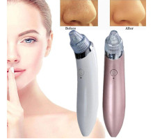 Вакуумний апарат для чищення пор  Beauty Skin Care Specialist XN-8030 Найкраща ціна! Вакуумний апарат для чищення пор  Beauty Skin Care Specialist XN-8030 Найкраща ціна!