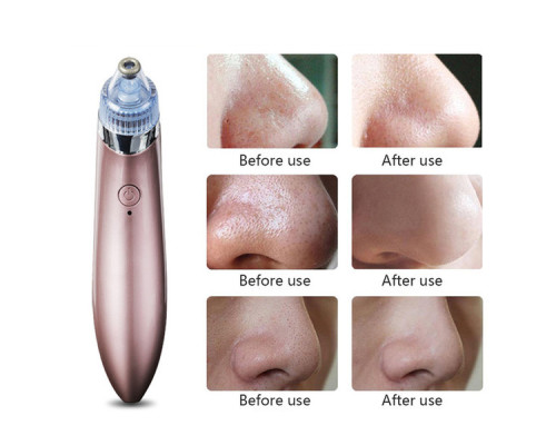 Вакуумний апарат для чищення пор  Beauty Skin Care Specialist XN-8030 Найкраща ціна!