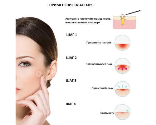 Пластир від прищів Acne Patch Пластир від прищів Acne Patch