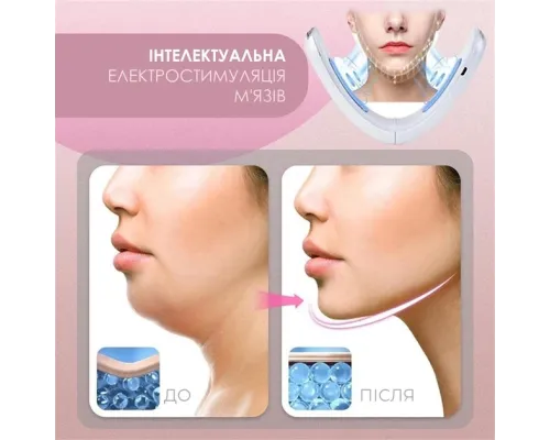 Аппарат для подтяжки подбородка V Face Beauty Meter 5 режимов 8 уровней интенсивности белый Аппарат для подтяжки подбородка V Face Beauty Meter 5 режимов 8 уровней интенсивности белый