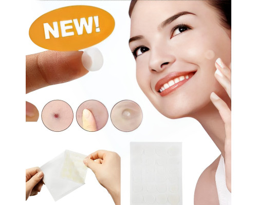 Пластир від прищів Acne Patch Пластир від прищів Acne Patch